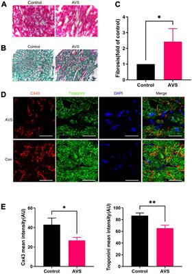 Expression of connexin 43 protein in cardiomyocytes of heart failure mouse model